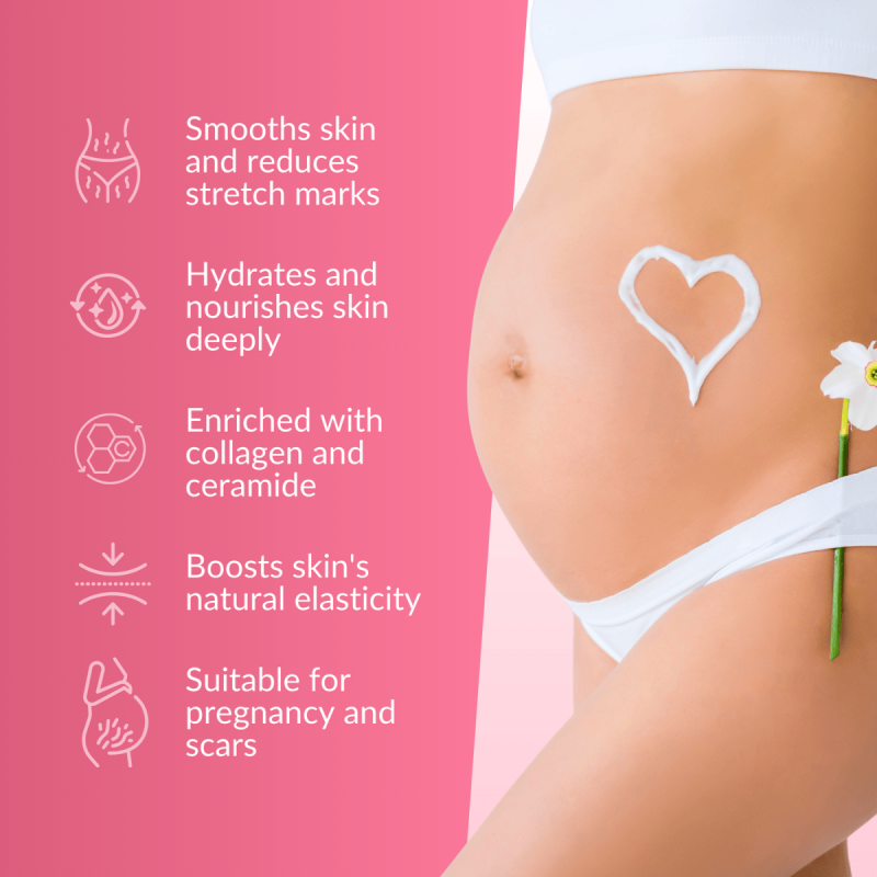 Best Stretch Mark Cream