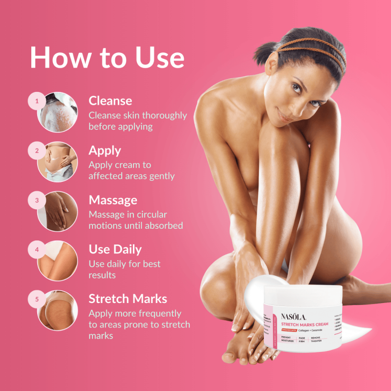 Stretch Mark Prevention Cream