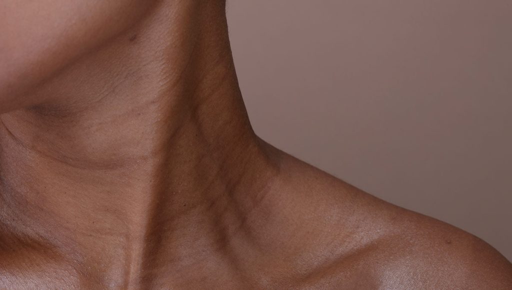 What Causes Crepey Skin on the Neck?